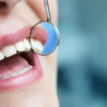 How A Periodontist Can Improve Your Smile