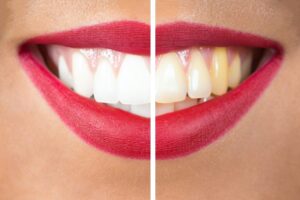 Cosmetic Dentistry